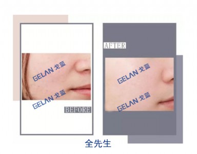 t(y)ĤNӹN Vݸ{(ln)